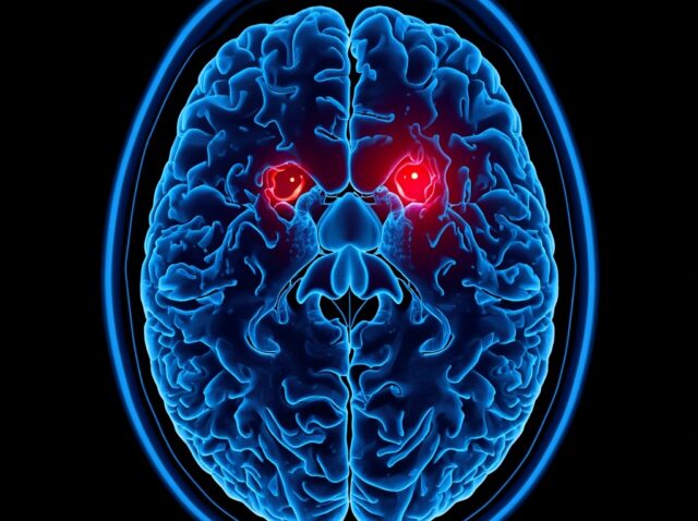 Traumatic Brain Injury